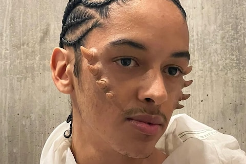 Community: Echo Seireeni